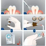 Bifluorid 10 monodose 50pz - immagine 4