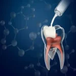 Biodentine kit 5pz - immagine 4