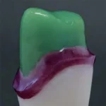 Cera modellazione cervicale