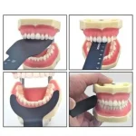 Come si usa un contrasto fotografia dentale