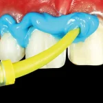 Elite HD+ light body normal setting - immagine 4