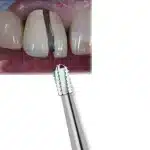 Fresa modello pera taglio corona