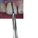 Fresa tungsteno taglio corona cilindrica piatta - immagine 3