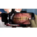 Kit fotografia dentale telefono Soft Light AL64 - immagine 2