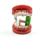 Apribocca con protezione lingua - immagine 5