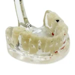 Modello denti da latte