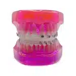 Modello didattico apparecchio metallo-ceramica - immagine 5