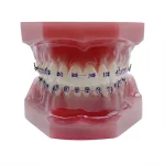 Modello didattico apparecchio ortodontico metallo 009 - immagine 4