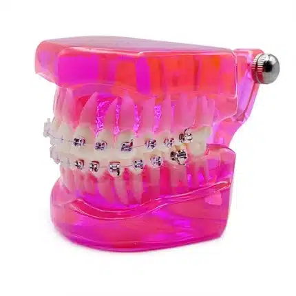 Modello didattico apparecchio metallo-ceramica