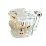 Modello dimostrativo patologie 31 denti