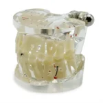 Modello dimostrativo pedodontico YL-C12