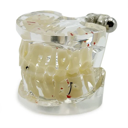 Modello dimostrativo pedodontico YL-C12