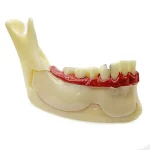 Modello dimostrativo mandibola sezione YL-N14 - immagine 2