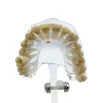 Modello dimostrativo patologie 31 denti - immagine 4