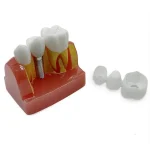 Modello dimostrativo impianto dentale YL-M3 - immagine 5