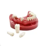 Simulatore preparazione cavità e monconi mandibola - immagine 5