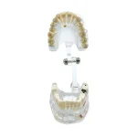 Modello trasparente con patologie