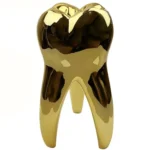 Molare dorato sopramobile 24cm