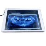 Negatoscopio radiografia NG1