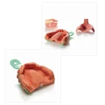 Neocolloid alginato protesi