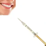 Opalescence quick siringa 4x1.2ml - immagine 3