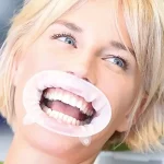 OptraGate 80pz - immagine 2