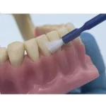 Profisil fluoride vernice denti