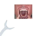 Retrattore labbra singolo per foto