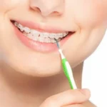 Scovolino interdentale pulizia denti