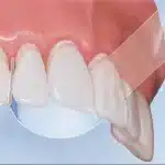 Strisce matrici trasparenti 50pz