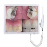 Telecamera intraorale monitor HD wifi