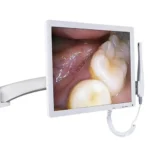 Telecamera intraorale riunito