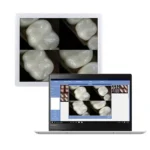 Telecamera intraorale wifi