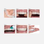 UltraEZ gel desensibilizzante siringa 1x1.2ml - immagine 3