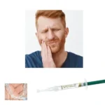 UltraEZ gel desensibilizzante denti